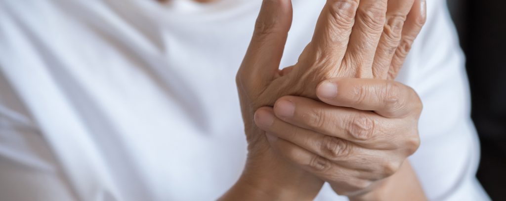 Rheumatoid Arthritis